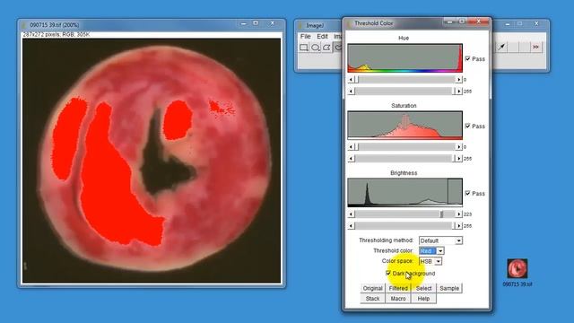 Using ImageJ to measure areas in histological samples смотреть онлайн