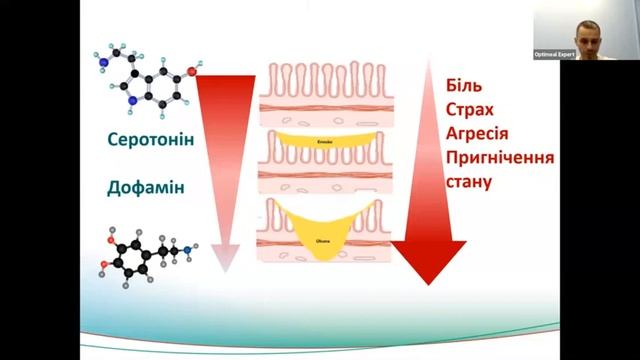 Гастроентерологія і ендокринологія. Сергій Сахнюк смотреть онлайн