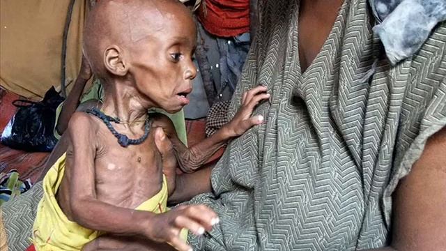 Starving In Africa/Голодающие в Африке.