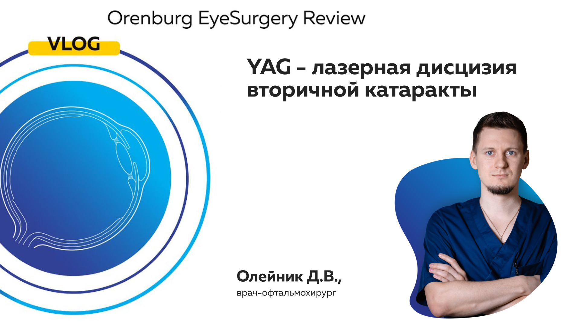 YAG - лазерная дисцизия вторичной катаракты