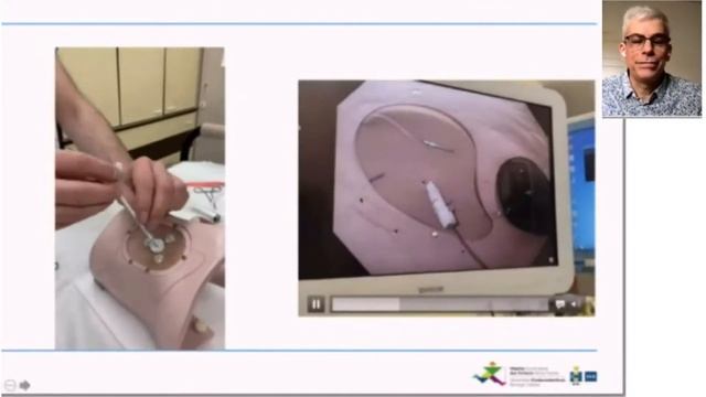 Прямая пункционная гастростомия у детей: советы и хитрости. Патрик Бонтемс. 21.05.2021