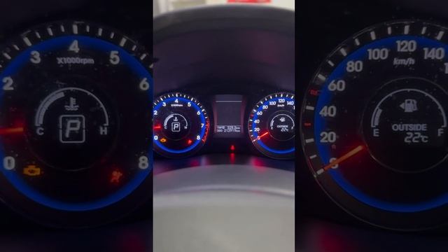 Hyundai I40 #automobile #mechancial #mechanic