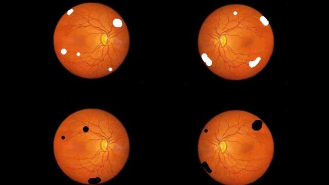 Типология периферического зрения. Введение. смотреть онлайн