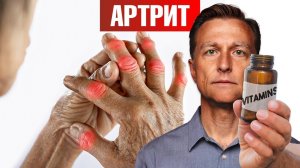 Лучший витамин от артрита (и это НЕ витамин Д)