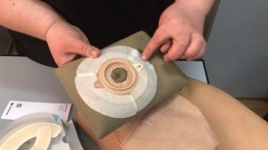 Использование полуколец для дополнительной фиксации пластины калоприемника или уроприемника