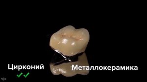 Металлокерамика или цирконий | Что лучше, какие коронки выбрать?