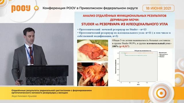 Запредельный опыт РЦЭ у женщин. Конференция РООУ в Приволжском ФО смотреть онлайн
