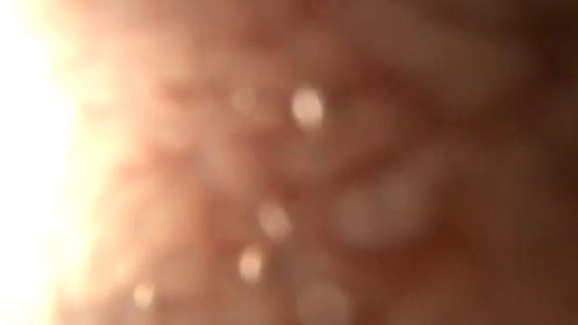 Глистная инвазия у кошки, дуоденоскопия www.endovet.com смотреть онлайн