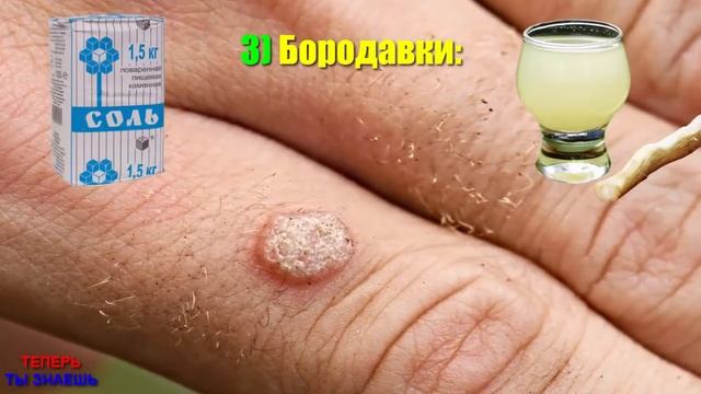 СОЛЬ ЛЕЧИТ Почти ВСЁ! Вот ПОЧЕМУ У Меня ВСЕГДА Дома Мешок СОЛИ... смотреть онлайн