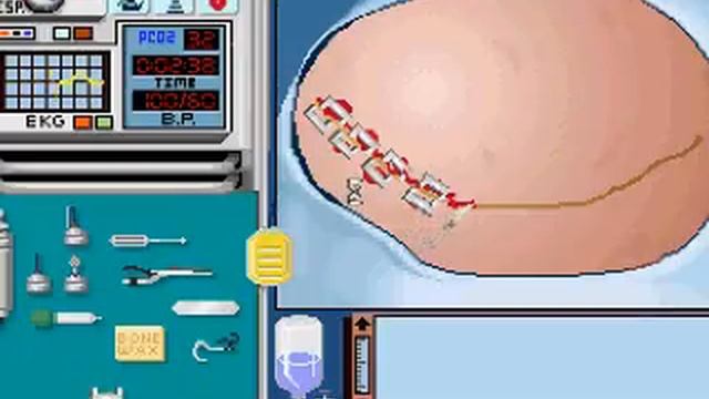 SKELETAL reviews Life and Death 2: The Brain (PC) смотреть онлайн