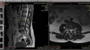 Разбор МРТ. Инструкция к программе RadiAnt DICOM Viewer