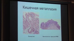 60 Беляков ММ Атрофический гастрит, кишечная метаплазия и дисплазия взгляд патоморфолога