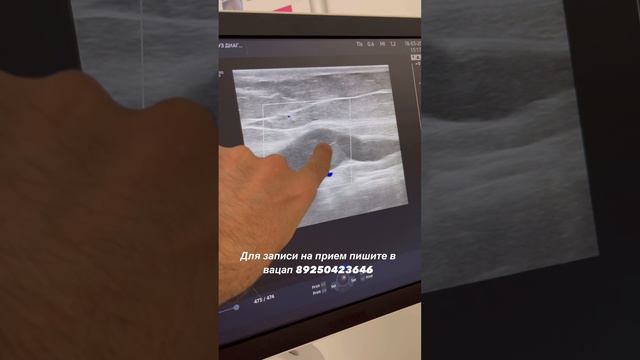 Обследование сосудов. Узи вен на ногах. Сосудистый хирург. Флеболог Москва. Флеболог. Узи сосудов