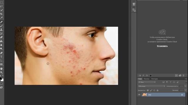 как убрать прыщи в фотошопе смотреть онлайн