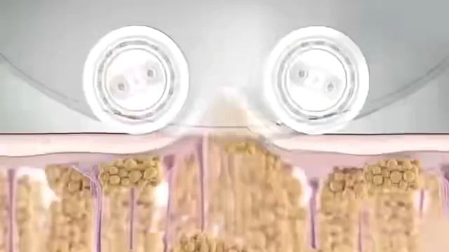 Вакуумно-роликовый аппарат для лица и тела В-56 смотреть онлайн