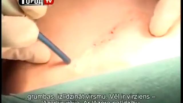 Пластическая хирургия смотреть онлайн