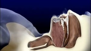 Как возникает храп и остановки дыхания во сне