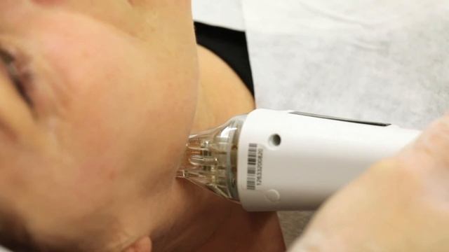 An introduction to 3D Dermaforce смотреть онлайн