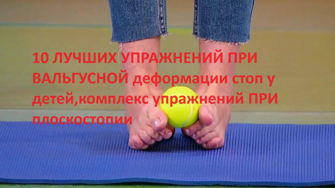 10 ЛУЧШИХ УПРАЖНЕНИЙ ПРИ ВАЛЬГУСНОЙ деформации стоп у детей,комплекс упражнений ПРИ плоскостопии смотреть онлайн