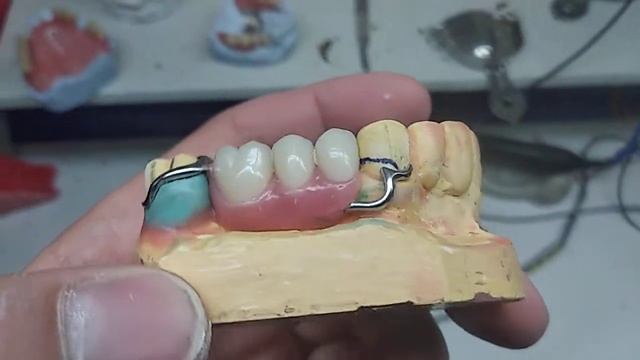 Бюгель смотреть онлайн