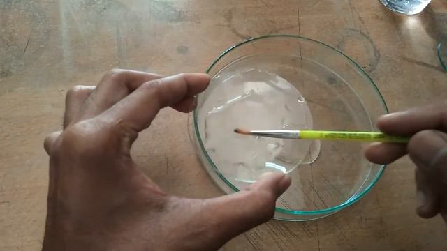 Study Of Mitosis Using Onion Root Tips || Squash Preparation || Stages Of Mitosis