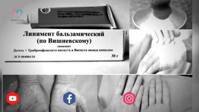 Bir zamanların məşhur Vişnevskiy mazı - Nələrə qadirdir? смотреть онлайн