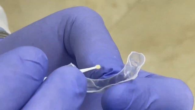 Dental digital impression, dental scanning by 3shape for clear aligner, putting the attachment on смотреть онлайн