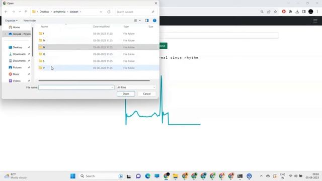 Arrhythmia Detection | Deep Learning | ECG Images Classification | Python Project | Machine Learnin смотреть онлайн