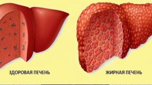Фосфоглив барои табобати бемории фиброз, цирроз ва дигар зарархои чигар (Печень).