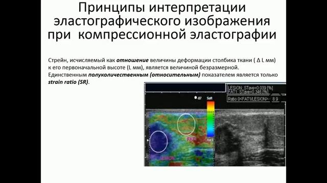 Введение в ЭЛАСТОГРАФИЮ
