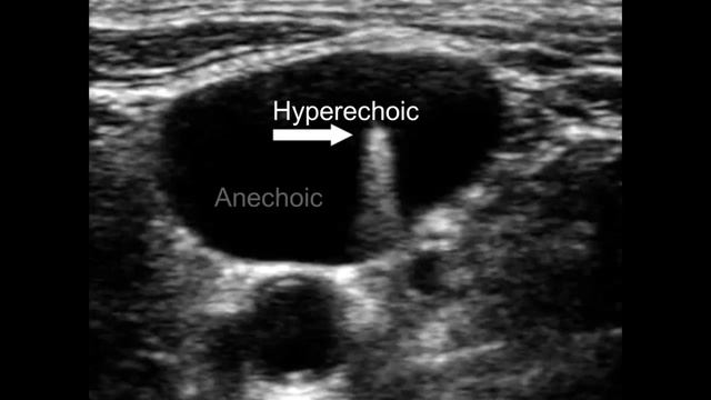 Roberts and Hedges Ultrasound Introduction смотреть онлайн