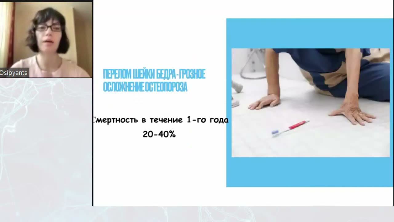 Остеопороз