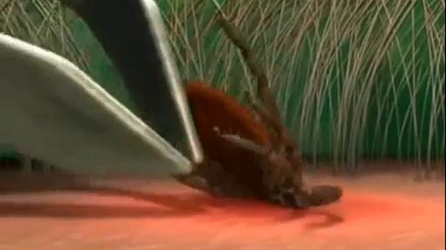 Как правильно вытащить клеща смотреть онлайн