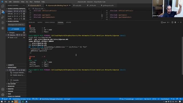 ? Supercharge GIT white space comparison with this VS Code technique! смотреть онлайн