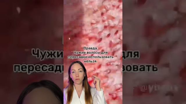 Пересадка волос ! Мифы или правда? смотреть онлайн