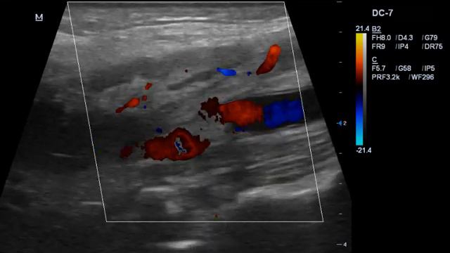 Интересный случай смотреть онлайн