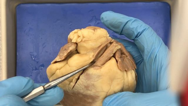 Sheep Heart and Model Anatomy Demo смотреть онлайн