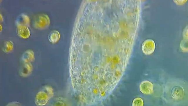 Инфузория в окружении одноклеточных водорослей./ Ciliate surrounded by unicellular algae. смотреть онлайн