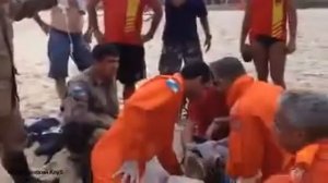 СЛР. Реальная ситуация.