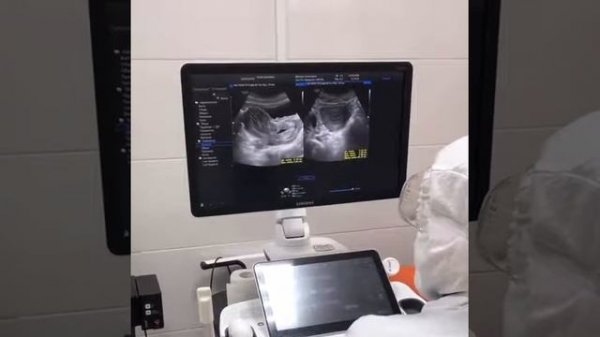 ГИНЕКОЛОГИЧЕСКОЕ УЗИ ОРГАНОВ МАЛОГО ТАЗА