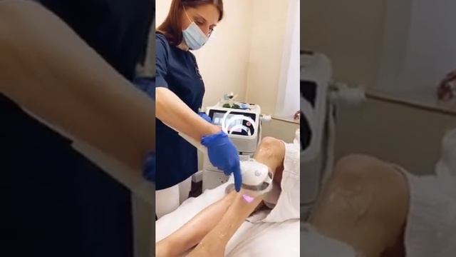 Лазерна епіляція лазер 6 покоління Monolith на Подолі зі SkinMedical смотреть онлайн