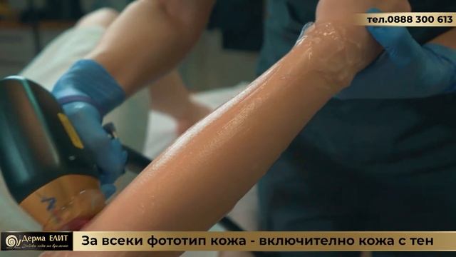 Soprano Ice Platinum клиника Дерма ЕЛИТ смотреть онлайн