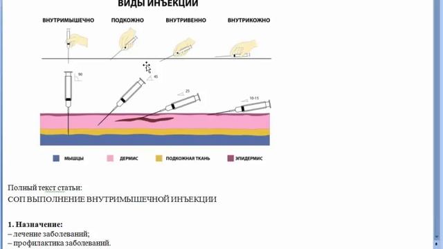 ВНУТРИМЫШЕЧНАЯ ИНЪЕКЦИЯ смотреть онлайн