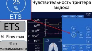 оптимизация ИВЛ по потоку Горячев А.С.