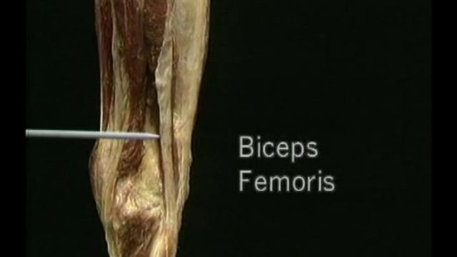 ТАЗ и НИЖНЯЯ КОНЕЧНОСТЬ| Атлас анатомии Акланда Фильм 2