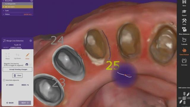 Digital Dentistry 2.0 May 25th 2023 смотреть онлайн