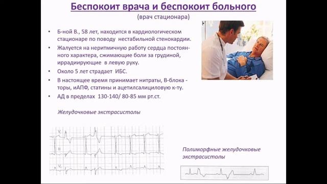 Чи завжди треба лікувати екстрасистолічну аритмію? смотреть онлайн