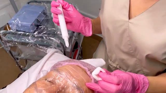 Процедура Холодная плазма. Обучающий центр PLASMADELIXE смотреть онлайн