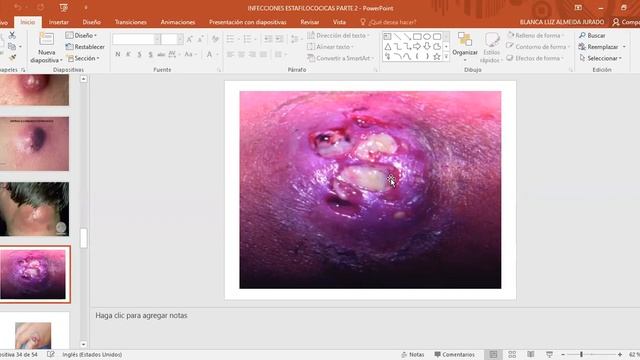 Clase 6 grupo 4 смотреть онлайн