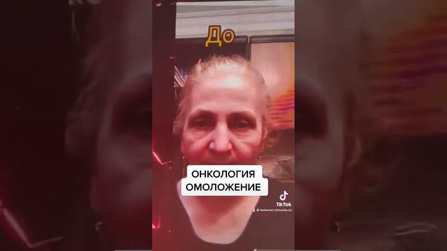 МНОГО РЕЗУЛЬТАТОВ ПО ПРОДУКЦИИ БЕВЕРЛИ смотреть онлайн